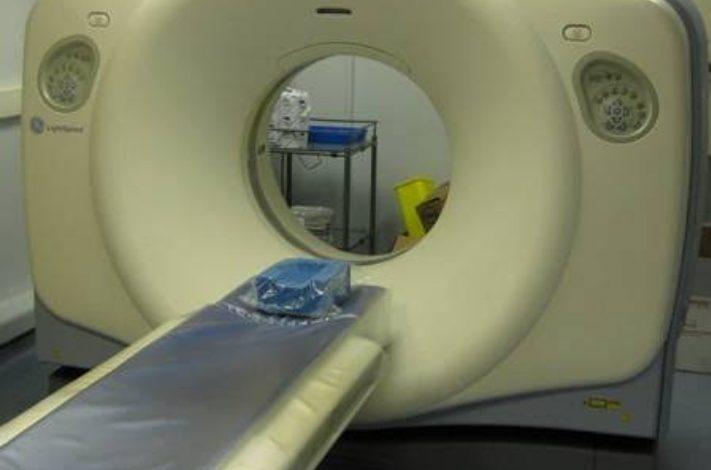 असर विशेष : इलाज करवाने तो आओ लेकिन टेस्ट करवाना 25 दिन बाद असर विशेष : इलाज करवाने तो आओ लेकिन टेस्ट करवाना 25 दिन बाद