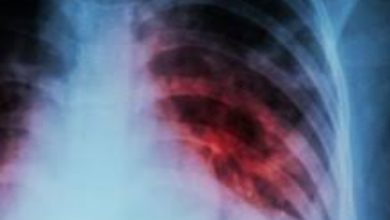 खास खबर : अब घर द्वार जाकर टीबी रोगियों की जांच में लाई जाएगी तेज़ी