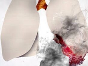 खतरा; विश्व में देश तम्बाकू उत्पादों का दूसरा सबसे बड़ा निर्माता व उपभोक्ता खतरा; विश्व में देश तम्बाकू उत्पादों का दूसरा सबसे बड़ा निर्माता व उपभोक्ता