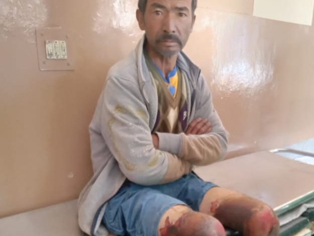 खास खबर: बेसहारा, जख्मी नेपाली मज़दूर की दर्दनाक हालत पर उमंग ने राज्यपाल को पत्र लिखा खास खबर: बेसहारा, जख्मी नेपाली मज़दूर की दर्दनाक हालत पर उमंग ने राज्यपाल को पत्र लिखा