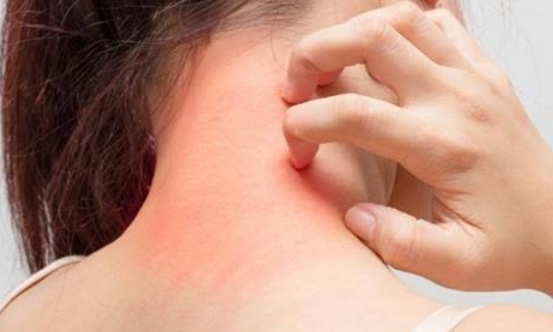 असर विशेष:घटिया सौंदर्य प्रसाधन और कॉस्मेटिक पर हिमाचल की पकड़ ढीली असर विशेष:घटिया सौंदर्य प्रसाधन और कॉस्मेटिक पर हिमाचल की पकड़ ढीली