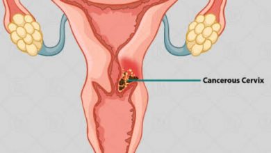 असर विशेष: सर्वाइकल कैंसर का जाल फैला हिमाचल में,  पर हिमाचल में जागरूकता ज़ीरो असर विशेष: सर्वाइकल कैंसर का जाल फैला हिमाचल में,  पर हिमाचल में जागरूकता ज़ीरो
