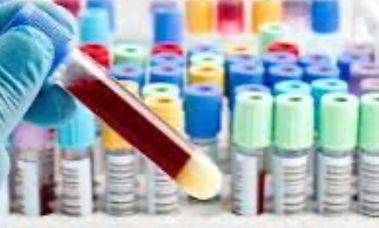 EXCLUSIVE: हिमाचल में डायग्नॉस्टिक लैबस का टेंडर रद्द EXCLUSIVE: हिमाचल में डायग्नॉस्टिक लैबस का टेंडर रद्द