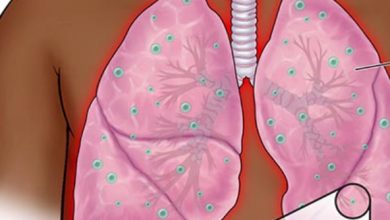 असर विशेष : टीबी मुक्त भारत अभियान में हिमाचल अव्वल असर विशेष : टीबी मुक्त भारत अभियान में हिमाचल अव्वल