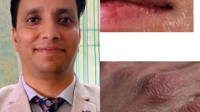 ठंड में खतरे की घंटी: सूखी हवा ने बढ़ाई त्वचा रोगों की समस्या ठंड में खतरे की घंटी: सूखी हवा ने बढ़ाई त्वचा रोगों की समस्या