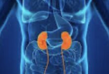 मरीजों पर संकट: निजी डायलिसिस केंद्रों ने 15 अप्रैल तक दी आखिरी चेतावनी मरीजों पर संकट: निजी डायलिसिस केंद्रों ने 15 अप्रैल तक दी आखिरी चेतावनी